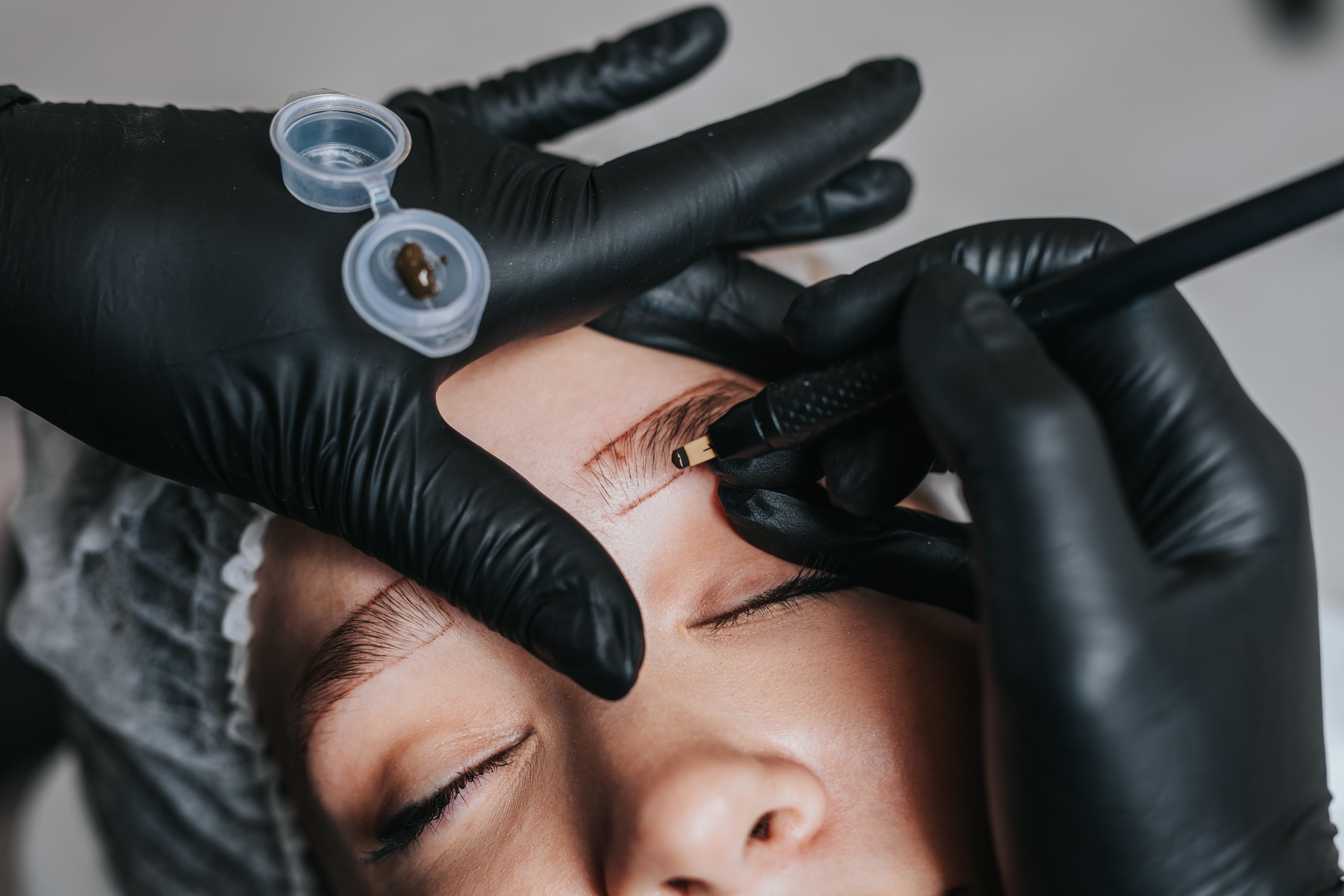 Treatment Image